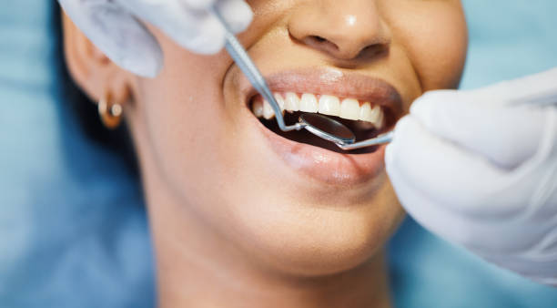 Best Urgent Care for Lost Fillings or Crowns in Strongsville, OH